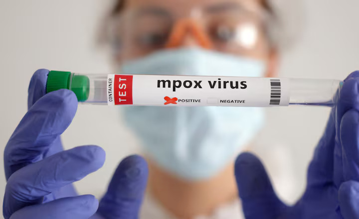 A test tube labelled "Mpox virus positive" is held in this illustration taken August 20, 2024.